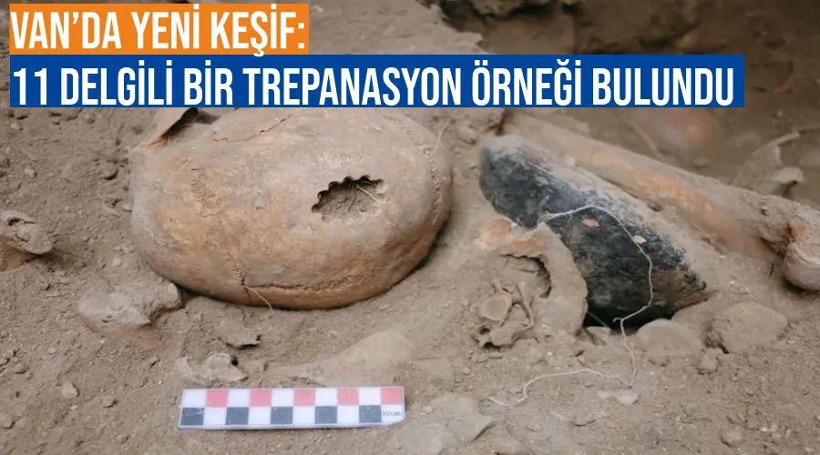 Van’da yeni keşif: 11 delgili bir trepanasyon örneği bulundu