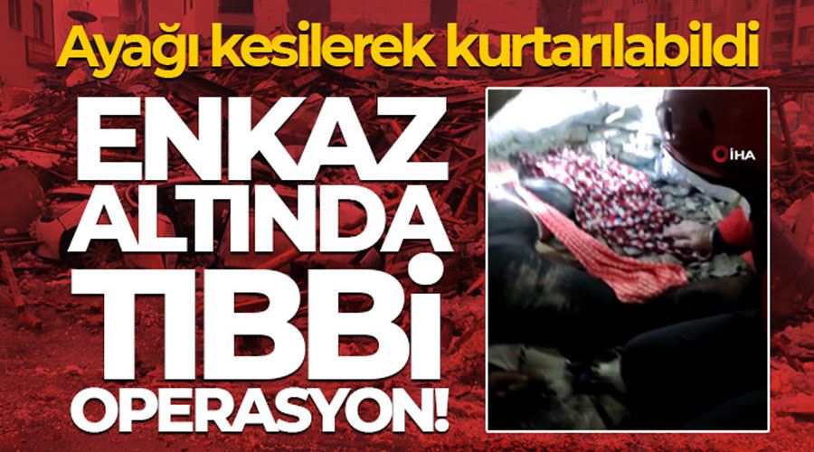 Enkaz altında tıbbi operasyon! Ayağı kesilerek kurtarılabildi