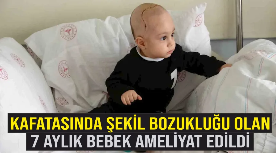 Kafatasında şekil bozukluğu olan 7 aylık bebek Van