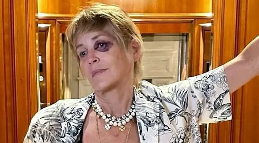 Şok kaza: Sharon Stone bodrum