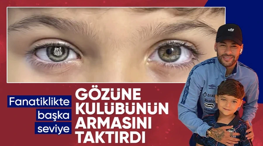 Santoslu Minik Taraftarın Gözünden Yansıyan Umut: Armalı Protez İle Hayata Tutundu