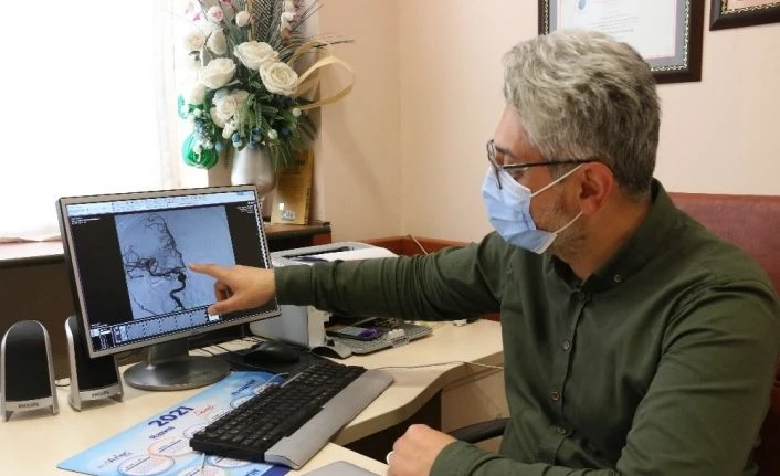 Her 6 saniyede 1 kişi inme geçiriyor, saatte 1 kişi hayatını kaybediyor
