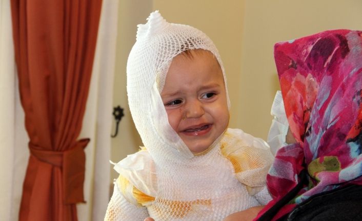 Erzincan’da üzerine kaynar süt dökülen çocuk hastanelik oldu