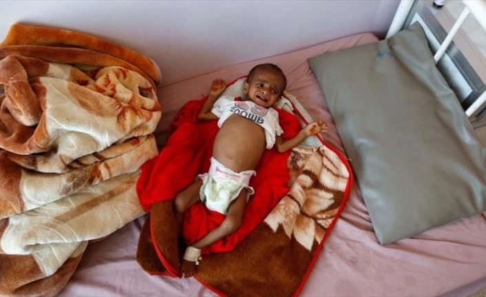 Yemen
